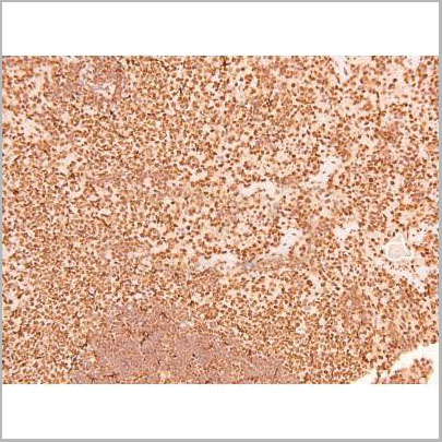 product-image-AAA31403_IHC5.jpg