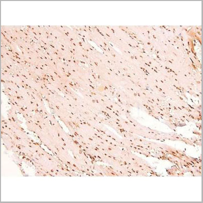 product-image-AAA31403_IHC6.jpg