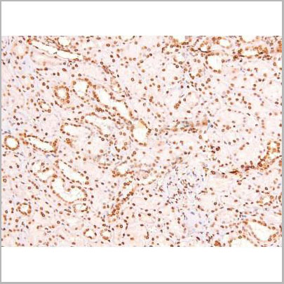 product-image-AAA31403_IHC7.jpg