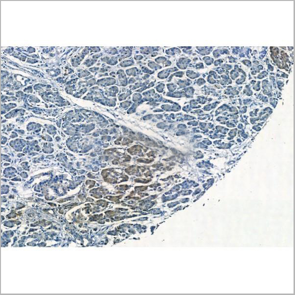 product-image-AAA31407_IHC2.jpg