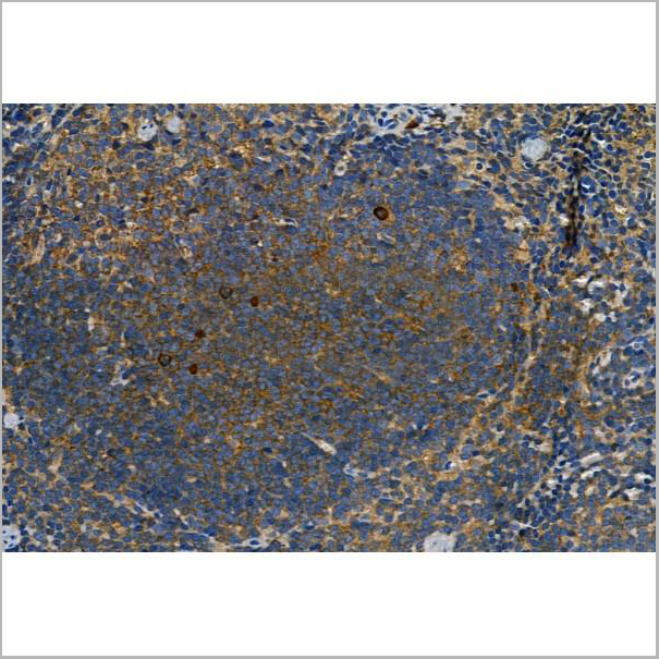 product-image-AAA31407_IHC3.jpg