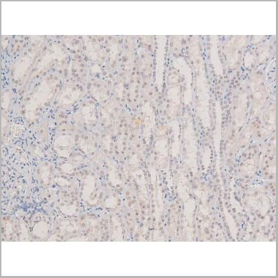 product-image-AAA31407_IHC4.jpg