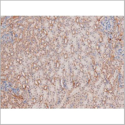 product-image-AAA31407_IHC6.jpg