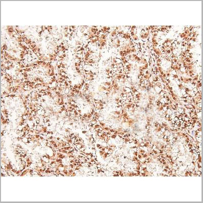 product-image-AAA31414_IHC4.jpg