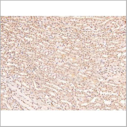 product-image-AAA31414_IHC5.jpg