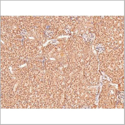 product-image-AAA31414_IHC6.jpg