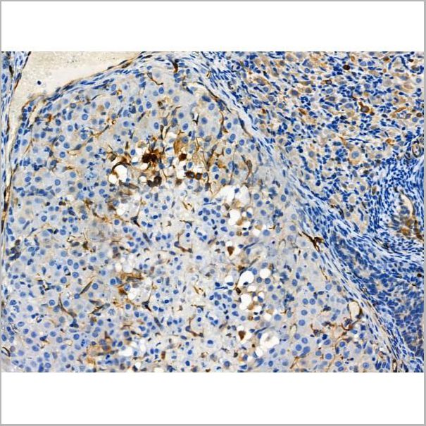 product-image-AAA31419_IHC4.jpg