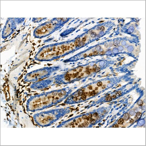 product-image-AAA31419_IHC5.jpg