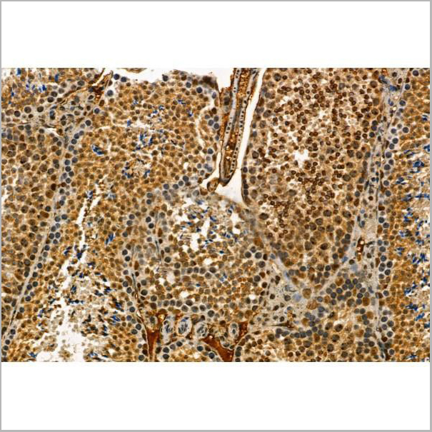 product-image-AAA31434_IHC6.jpg