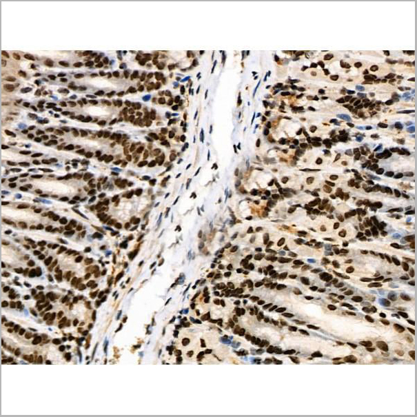 product-image-AAA31446_IHC12.jpg