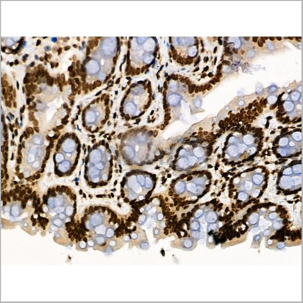 product-image-AAA31446_IHC4.jpg