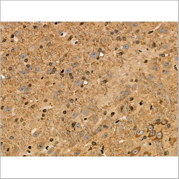 product-image-AAA31446_IHC5.jpg