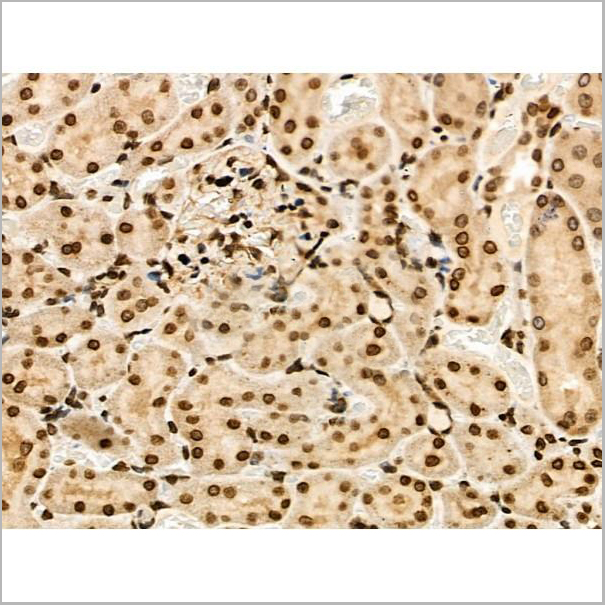 product-image-AAA31446_IHC6.jpg