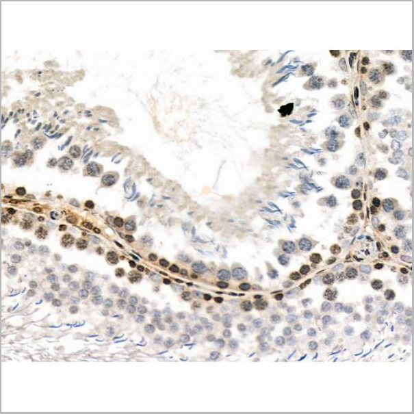 product-image-AAA31450_IHC2.jpg