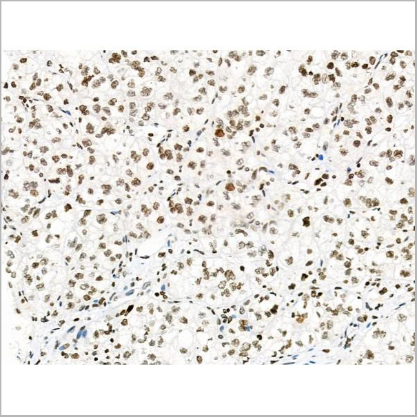 product-image-AAA31450_IHC6.jpg