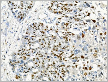 product-image-AAA31461_IHC4.jpg