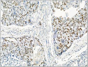 product-image-AAA31461_IHC5.jpg