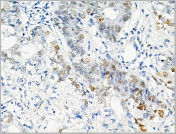 product-image-AAA31461_IHC6.jpg