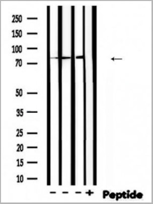 product-image-AAA31470_WB.jpg