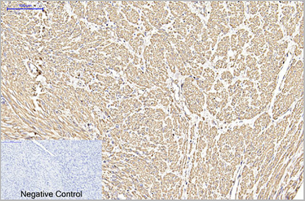 product-image-AAA31477_IHC5.jpg
