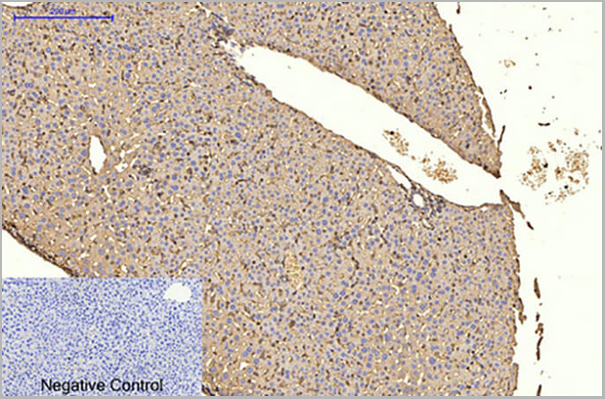 product-image-AAA31477_IHC6.jpg