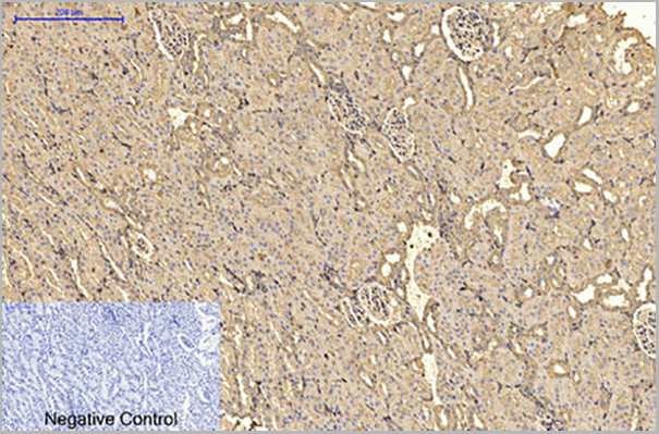 product-image-AAA31477_IHC7.jpg