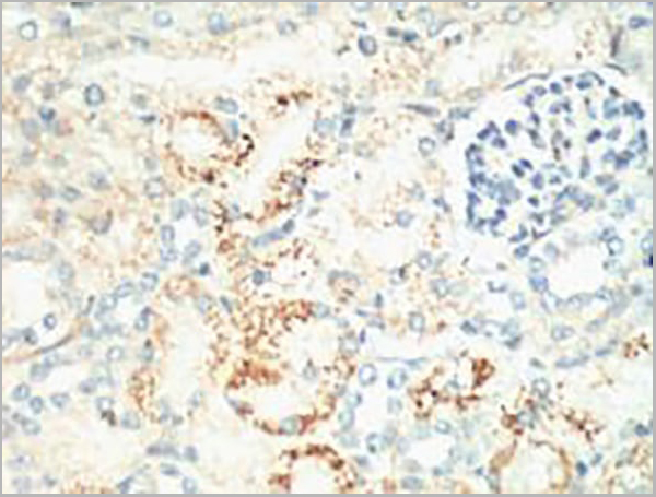 product-image-AAA31478_IHC.jpg