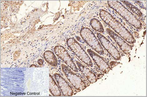 product-image-AAA31539_IHC2.jpg