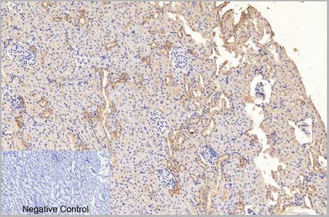 product-image-AAA31539_IHC4.jpg