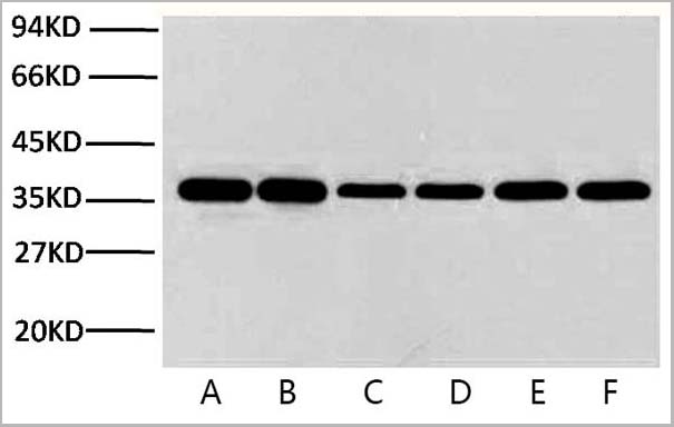 product-image-AAA31539_WB.jpg