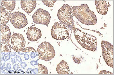 product-image-AAA31540_IHC5.jpg