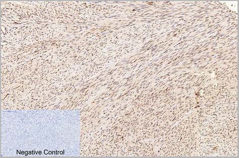 product-image-AAA31541_IHC4.jpg
