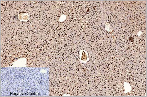 product-image-AAA31541_IHC5.jpg