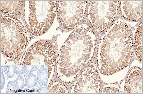 product-image-AAA31541_IHC6.jpg