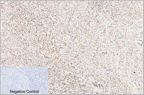 product-image-AAA31542_IHC2.jpg