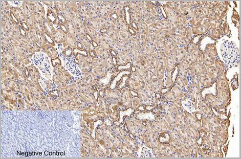 product-image-AAA31542_IHC4.jpg