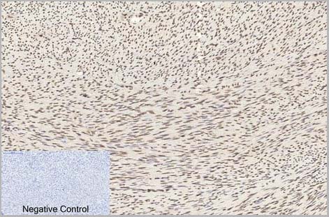 product-image-AAA31543_IHC2.jpg