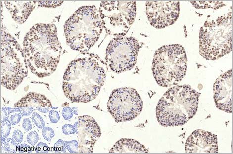 product-image-AAA31543_IHC3.jpg