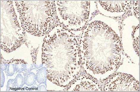 product-image-AAA31543_IHC4.jpg