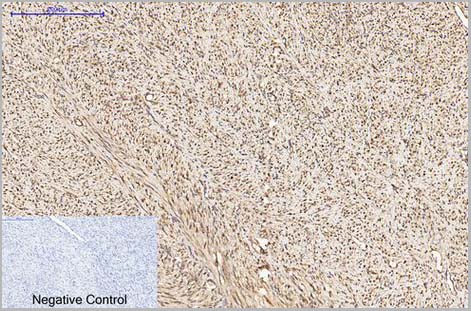 product-image-AAA31544_IHC4.jpg