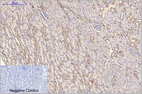 product-image-AAA31544_IHC6.jpg