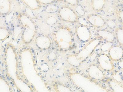 product-image-AAA323576_IHC.jpg