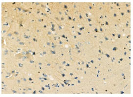 product-image-AAA328036_IHC.png