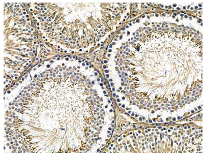 product-image-AAA330064_IHC.png