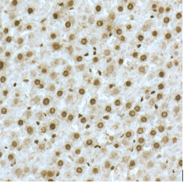 product-image-AAA333000_IHC.jpg