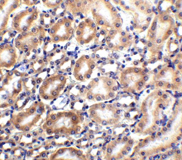 product-image-AAA40050_IHC10.gif