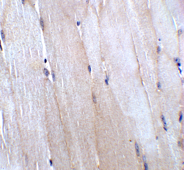 product-image-AAA40840_IHC13.gif