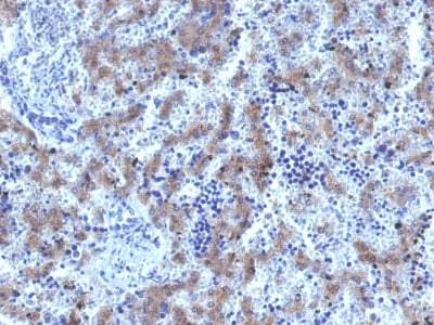 product-image-AAA63000_IHC15.jpg